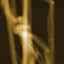 AFM topography image of collagen