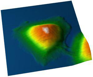 Topography of a HeLa cell