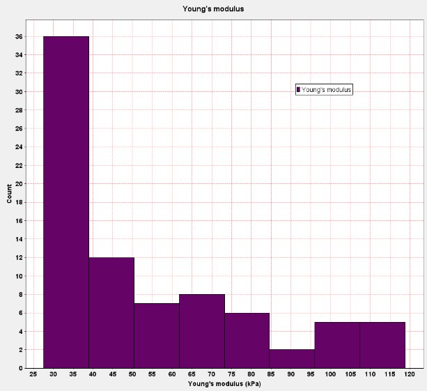 histogram