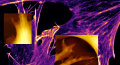 Mouse fibroblasts in cell culture medium