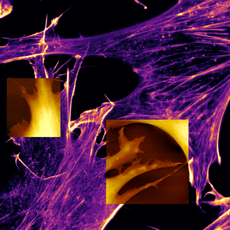 Mouse fibroblasts in cell culture medium