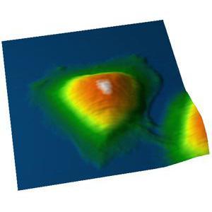 AFM topography of a living HeLa cell