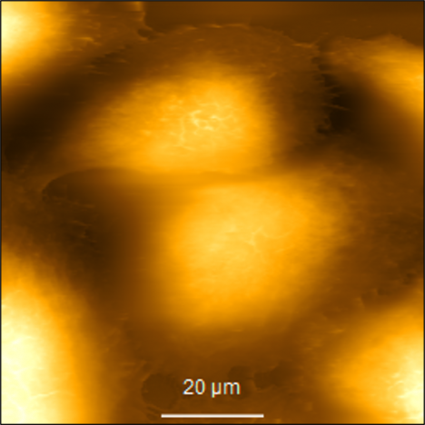 HeLa cells in culture medium